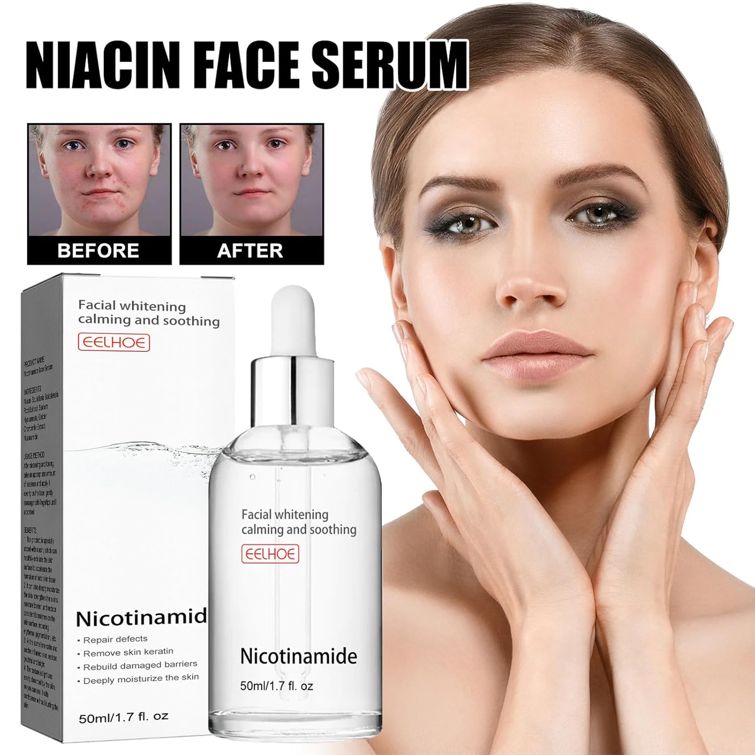 Serum Nicotinamida